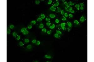 Immunofluorescence staining of Hela cells (treated with 30mM sodium butyrate for 4h) with ABIN7139151 at 1:2. (Histone H2B 抗体  (acLys116))