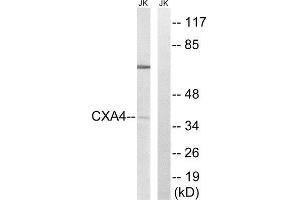 Western Blotting (WB) image for anti-Gap Junction Protein, alpha 4, 37kDa (GJA4) (Internal Region) antibody (ABIN1851365) (GJA4 抗体  (Internal Region))