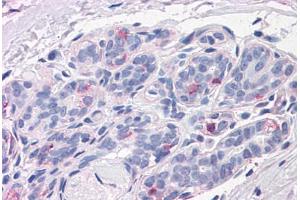 Human Breast: Formalin-Fixed, Paraffin-Embedded (FFPE) (NPTN 抗体  (N-Term))