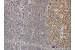 Immunoperoxidase of monoclonal antibody to RAB21 on formalin-fixed paraffin-embedded human tonsil.