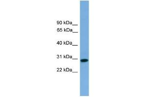 WB Suggested Anti-RCAN2 Antibody Titration: 0. (RCAN2 抗体  (Middle Region))