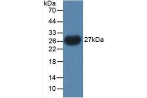 Detection of Recombinant PTHrP, Gallus using Polyclonal Antibody to Parathyroid Hormone Related Protein (PTHrP)
