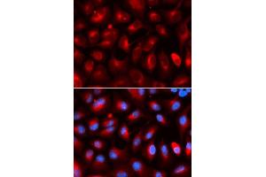 Immunofluorescence analysis of U2OS cells using KLC1 antibody. (KLC1 抗体  (AA 261-560))