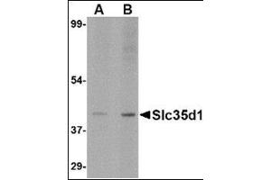 Western Blotting (WB) image for anti-Solute Carrier Family 35 (UDP-Glucuronic Acid/UDP-N-Acetylgalactosamine Dual Transporter), Member D1 (SLC35D1) (N-Term) antibody (ABIN500742)