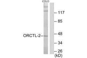 Western blot analysis of extracts from COLO205 cells, using ORCTL-2 antibody. (ORCTL-2/SLC22A18 抗体  (C-Term))