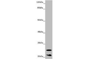 Western blot All lanes: CRYGS antibody at 6. (CRYGS 抗体  (AA 1-178))