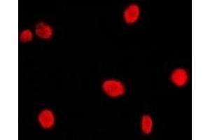 Immunofluorescent analysis of CBP20 staining in Hela cells. (NCBP2 抗体  (N-Term))