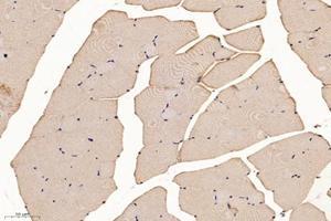 Immunohistochemistry analysis of paraffin-embedded mouse skeletal muscle using SLC8A3 (ABIN7075684) at dilution of 1: 1600 (SLC8A3 抗体)