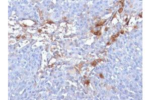 Image no. 3 for anti-Melanoma Cell Adhesion Molecule (MCAM) antibody (ABIN6153528) (MCAM 抗体)