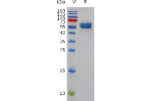 SDS-PAGE (SDS) image for CD84 (CD84) (AA 22-221) protein (Fc Tag) (ABIN7491065)