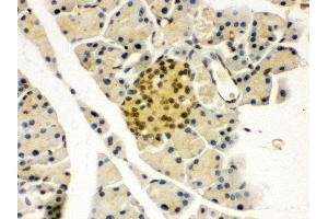 Immunohistochemistry (IHC) image for anti-Paired Box 6 (PAX6) (AA 195-233), (Middle Region) antibody (ABIN3043379)