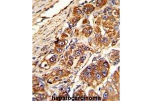 Immunohistochemistry (IHC) image for anti-Kinesin Light Chain 1 (KLC1) antibody (ABIN3003845) (KLC1 抗体)