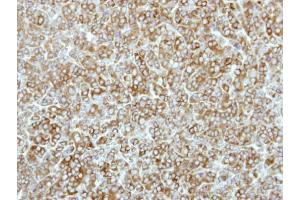 IHC-P Image Immunohistochemical analysis of paraffin-embedded BT483 xenograft, using eEF-2K, antibody at 1:500 dilution. (EEF2K 抗体  (N-Term))