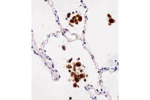 Paraformaldehyde-fixed, paraffin embedded Human lungtissue, Antigen retrieval by boiling in sodium citrate buffer (pH6. (FABP4 抗体)