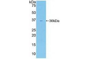 Detection of Recombinant IL22R, Human using Polyclonal Antibody to Interleukin 22 Receptor (IL22R) (IL22R 抗体  (AA 267-565))