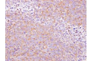 IHC-P Image Immunohistochemical analysis of paraffin-embedded H1299 xenograft , using SCY1 like 3, antibody at 1:500 dilution. (SCYL3 抗体  (Center))
