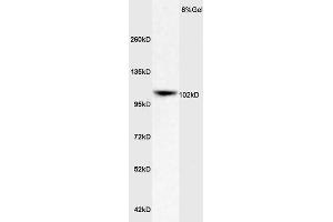 Rat Brain lysates probed with Rabbit Anti-ApoER2 Polyclonal Antibody (ABIN719426) at 1:200 in 4 °C. (LRP8 抗体  (AA 851-963))