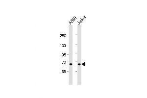 Western Blot at 1:1000 dilution Lane 1: A549 whole cell lysate Lane 2: Jurkat whole cell lysate Lysates/proteins at 20 ug per lane. (Factor XI 抗体  (AA 281-307))