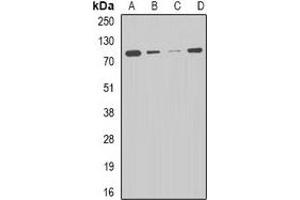 Western blot analysis of CPT2 expression in HepG2 (A), THP1 (B), mouse liver (C), mouse heart (D) whole cell lysates. (CPT2 抗体)