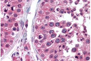 Human Testis (formalin-fixed, paraffin-embedded) stained with TEGT antibody ABIN290214 at 5 ug/ml followed by biotinylated anti-mouse IgG secondary antibody ABIN481714, alkaline phosphatase-streptavidin and chromogen. (Bax Inhibitor 1 抗体)