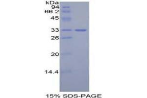 SDS-PAGE analysis of Mouse GLI3 Protein. (GLI Family Zinc Finger Protein 3 蛋白)