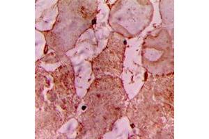 Immunohistochemical analysis of CARK staining in human heart formalin fixed paraffin embedded tissue section. (TNNI3K 抗体  (Center))