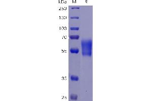 SDS-PAGE (SDS) image for Programmed Cell Death 1 (PDCD1) (AA 25-167) protein (Fc-His Tag) (ABIN6961149)