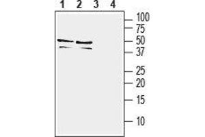 Western Blotting (WB) image for anti-Triggering Receptor Expressed On Myeloid Cells 2 (TREM2) (AA 42-56), (Extracellular) antibody (ABIN7043865)