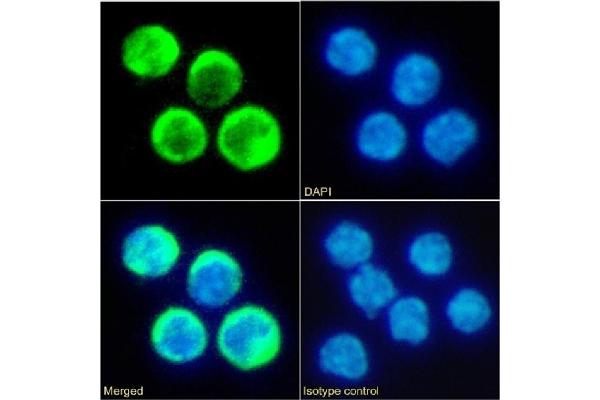 Recombinant TIMD2 抗体  (Extracellular Domain)
