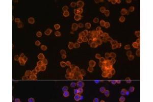 Immunofluorescence analysis of Raw264. (CD44 抗体)