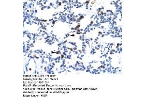Human Lung (E2F6 抗体  (Middle Region))