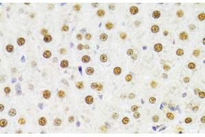 Immunohistochemistry of paraffin-embedded Rat liver using HDGF Polyclonal Antibody at dilution of 1:100 (40x lens). (HDGF 抗体)