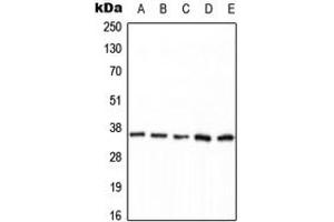 Western blot analysis of PPP2CA (pY307) expression in HEK293T EGF-treated (A), MCF7 (B), mouse brain (C), NIH3T3 (D), H9C2 EGF-treated (E) whole cell lysates. (PPP2CA 抗体  (C-Term, pTyr307))