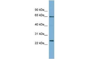 WB Suggested Anti-HOM-TES-103  Antibody Titration: 0. (IFFO1 抗体  (N-Term))