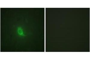 Immunofluorescence analysis of HuvEc cells, using SEPARASE (Phospho-Ser801) Antibody. (Separase 抗体  (pSer801))