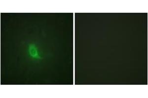 Immunofluorescence analysis of HuvEc cells, using SEPARASE (Phospho-Ser801) Antibody. (Separase 抗体  (pSer801))