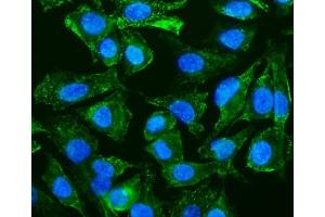 IF analysis of Caveolin-2/CAV2 using anti-Caveolin-2/CAV2 antibody (ABIN7601170).