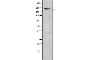 Western blot analysis of MYH11 using LOVO whole cell lysates (MYH11 抗体  (C-Term))
