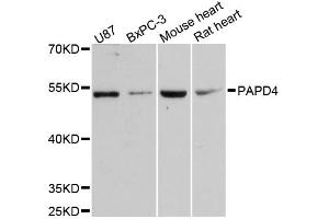 Western blot analysis of extracts of various cell lines, using PAPD4 antibody. (PAPD4 抗体)