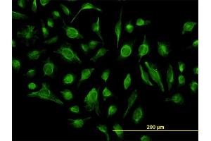 Immunofluorescence of monoclonal antibody to GABBR1 on HeLa cell. (GABBR1 抗体  (AA 52-151))