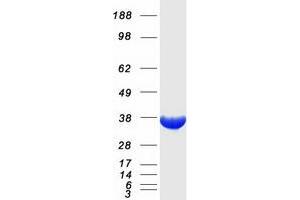 Western Blotting (WB) image for Quinolinate Phosphoribosyltransferase (QPRT) protein (Myc-DYKDDDDK Tag) (ABIN2730254)