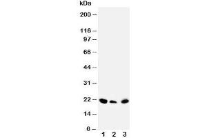 Western blot testing of DUSP3 antibody and Lane 1:  rat testis;  2: human SKOV;  3: (h) MM453 cell lysate (Dual Specificity Phosphatase 3 (DUSP3) (C-Term) 抗体)