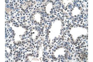 PPIB antibody was used for immunohistochemistry at a concentration of 4-8 ug/ml to stain Alveolar cells (arrows) in Human Lung. (PPIB 抗体)