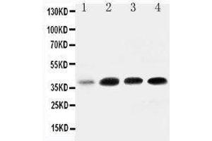 Anti-IGFBP3 antibody, Western blotting All lanes: Anti IGFBP3  at 0. (IGFBP3 抗体  (Middle Region))
