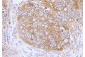 Immunohistochemistry (IHC) image for anti-Eukaryotic Translation Initiation Factor 3 Subunit A (EIF3A) (AA 860-910) antibody (ABIN7453842) (EIF3A 抗体  (AA 860-910))