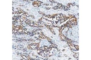 IHC analysis of Cytokeratin 20/Krt20 using anti-Cytokeratin 20/Krt20 antibody (ABIN7601133). (KRT20 抗体  (AA 29-431))