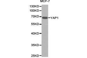 Western Blotting (WB) image for anti-Yes-Associated Protein 1 (YAP1) antibody (ABIN1875372) (YAP1 抗体)