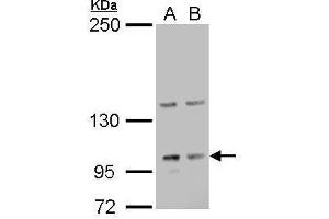 WB Image Laminin gamma 2 antibody detects Laminin gamma 2 protein by Western blot analysis. (LAMC2 抗体)