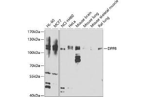 Western blot analysis of extracts of various cell lines, using DPP8 antibody (ABIN6130315, ABIN6139800, ABIN6139801 and ABIN6222925) at 1:1000 dilution. (DPP8 抗体  (AA 10-230))