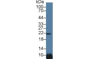 Detection of CSN1 in Human Hela cell lysate using Polyclonal Antibody to Casein Alpha (CSN1) (Casein alpha S1 抗体  (AA 16-185))
